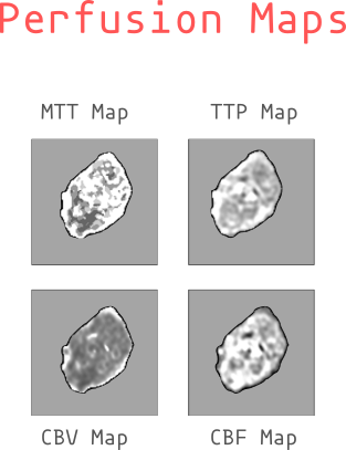 Perfusion Maps