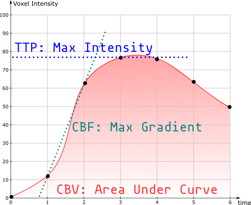 Perfusion Curve
